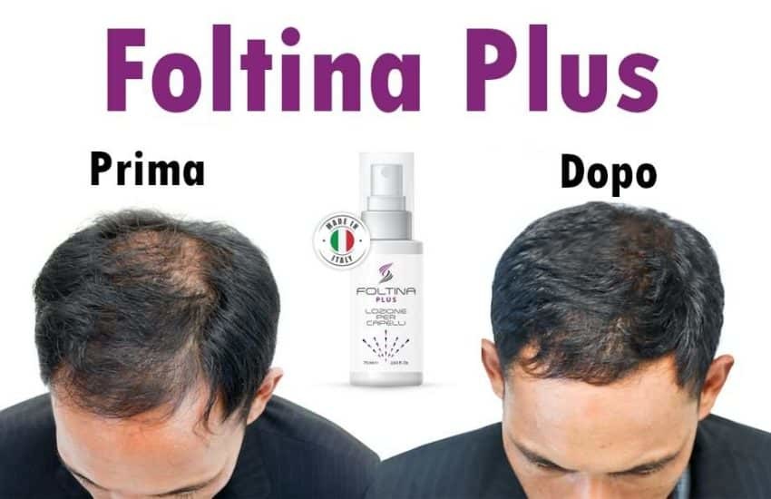 Foltina Plus, prima e dopo